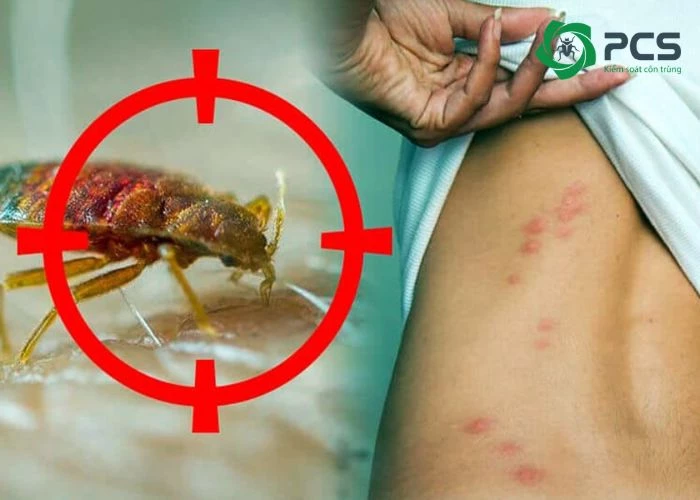 Vì sao cần diệt bọ chét ngay?